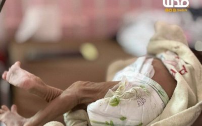 7 Nyawa Kembali Melayang Akibat Kelaparan, Gaza Resmi Capai Tingkat Famine