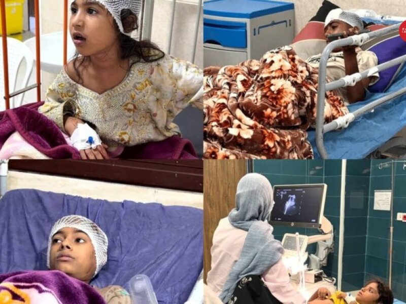 Serangan AS di Iran Tewaskan 18 Orang dan Lukai 108 Lainnya