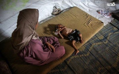 Gaza Sudah Masuk Fase Kelaparan Ekstrem, Kepala UNRWA Peringatkan Dunia Segera Bertindak