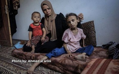 Lebih dari 14.800 Pasien Gaza dalam Kondisi Kritis, WHO Teriak Minta Bantuan