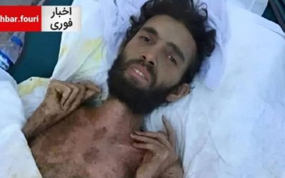 Ajaib! Setelah 3 Bulan Tertimbun Reruntuhan Gempa, Pria Suriah Ditemukan Selamat