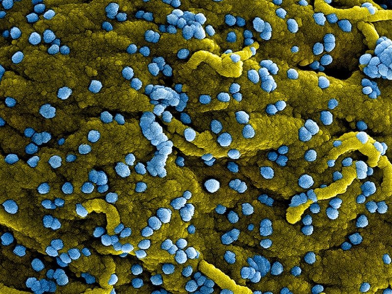 Kamerun Deteksi Dua Kasus Dugaan Virus Marburg yang Mematikan di Dekat Guinea Khatulistiwa