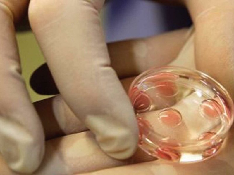 Jumlah wanita yang membekukan sel telurnya meningkat di UEA