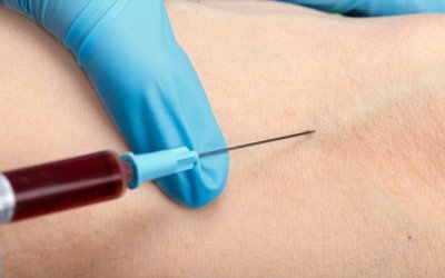 Mengambil sampel darah untuk diagnosa tidak membatalkan puasa?