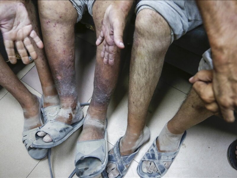 Tentara Zionis Membunuh Tahanan Palestina Sesaat Setelah Dibebaskan