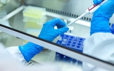 WHO: 90% orang yang terinfeksi hepatitis tidak menyadari status infeksi mereka