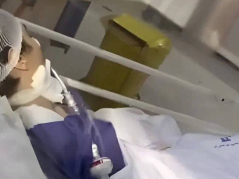 Kasus Mahsa Amini Terulang, Kini Remaja Perempuan Koma Usai Digebuki Polisi Iran