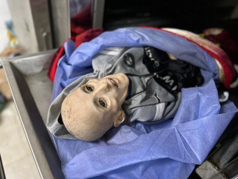 Kisah Yazan Kafarneh, Bocah Lelaki yang Meninggal akibat Kelaparan di Gaza