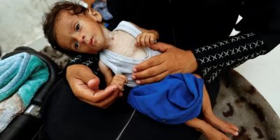 Foto Anak-Anak yang Kelaparan di Gaza: Bukti yang Membantah Klaim Netanyahu