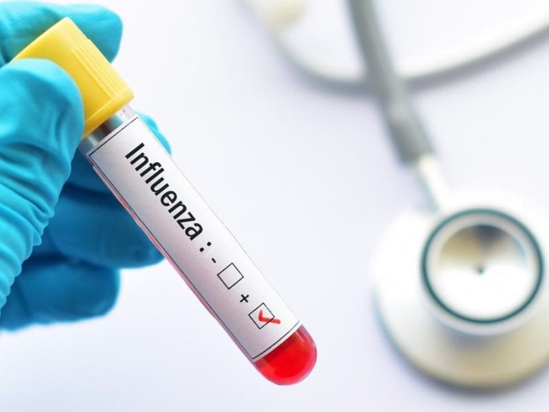 Kemenkes Temukan 62 Kasus Super Flu di Indonesia, Situasi Disebut Masih Terkendali