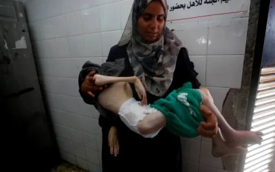 Tamer Shuheibar, Bocah Gaza Lainnya Tewas Kelaparan di Pelukan Ibunya