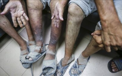 Tentara Zionis Membunuh Tahanan Palestina Sesaat Setelah Dibebaskan