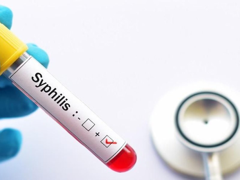 Kasus sifilis di DIY melonjak, didominasi oleh kaum gay