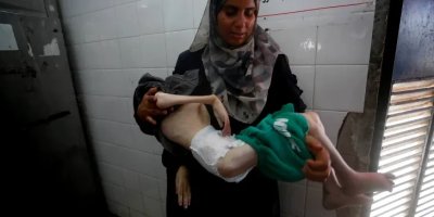 Tamer Shuheibar, Bocah Gaza Lainnya Tewas Kelaparan di Pelukan Ibunya