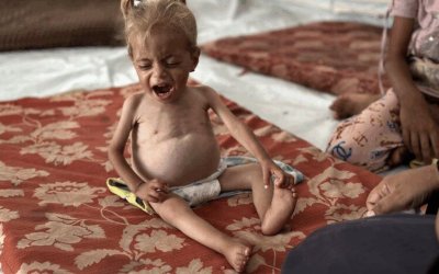 PBB Resmi Nyatakan Kelaparan di Gaza, Separuh Juta Warga Hadapi Ancaman Kematian