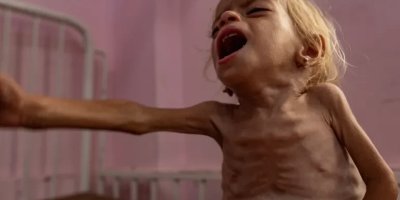 Guterres: Kelaparan Gaza Tragedi Buatan Manusia, “Israel” Harus Bertanggung Jawab