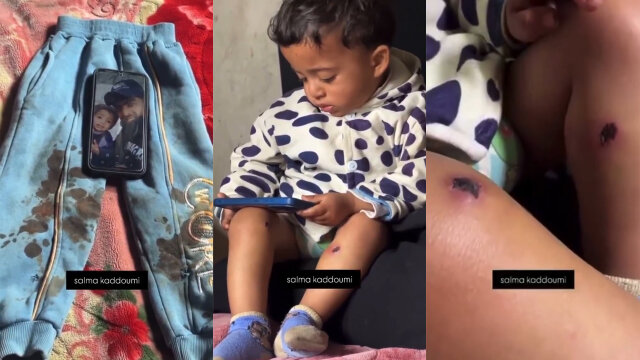 Balita di Gaza Disiksa IDF Buat Paksa Ayahnya Ngaku, Disundut Rokok dan Ditusuk Paku