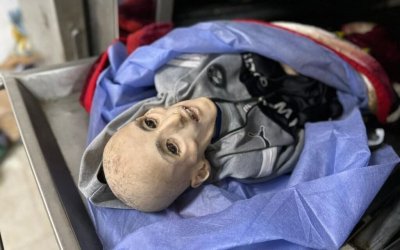 Kisah Yazan Kafarneh, Bocah Lelaki yang Meninggal akibat Kelaparan di Gaza