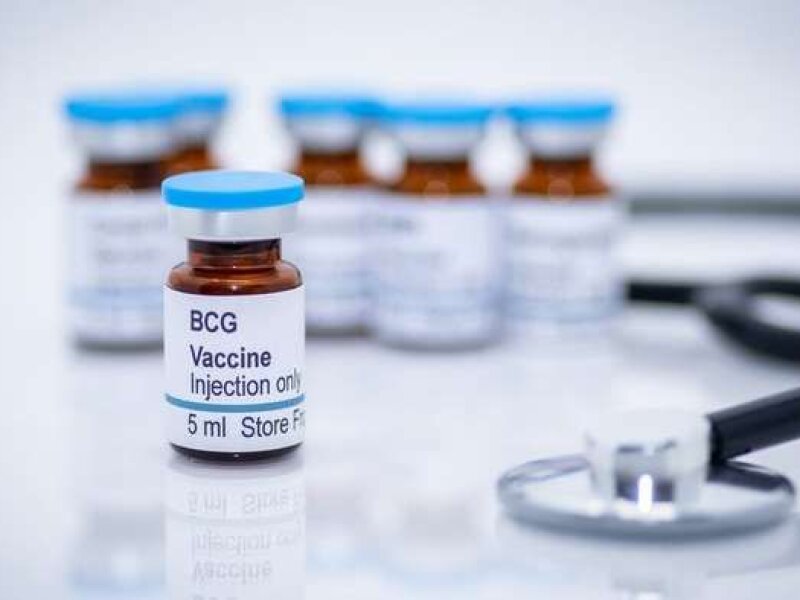 Terobosan Baru Kemenkes: Durasi Pengobatan TBC Dipangkas Jadi Hanya 1 Bulan untuk Tekan Angka Putus Obat