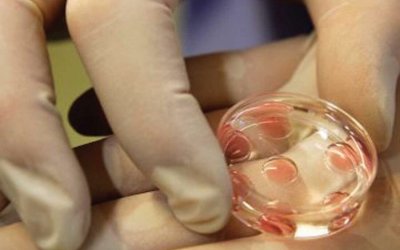 Jumlah wanita yang membekukan sel telurnya meningkat di UEA