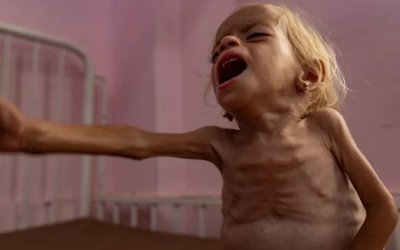 Guterres: Kelaparan Gaza Tragedi Buatan Manusia, “Israel” Harus Bertanggung Jawab